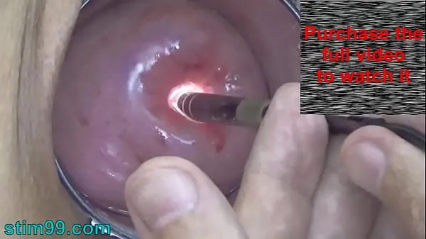 Hiển thị Endoscopic Camera in Cervix watch inside my Womb and Vagina. Inspection testing exam of wife by extreme doctor gynecologist Clip mới