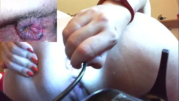 Show Medical anal endoscope fisting and extreme masturbation new Clips